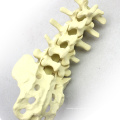TF02 (12313) Orthopädische Lendenwirbelsäule Skelett Praxis Pädagogisches Modell